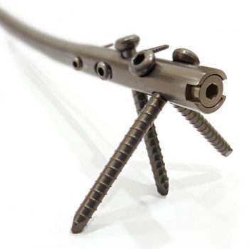 Expert Tibia Nailing System