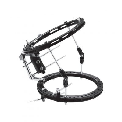 Hybrid Fixation and Ring Fixator