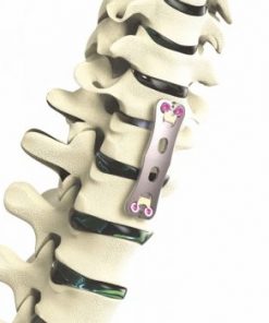 Apex Anterior Cervical Plate System