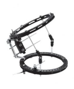 Hybrid Fixation and Ring Fixator