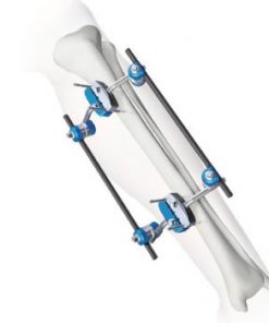 Bonofix Fixation System (Hoffman)